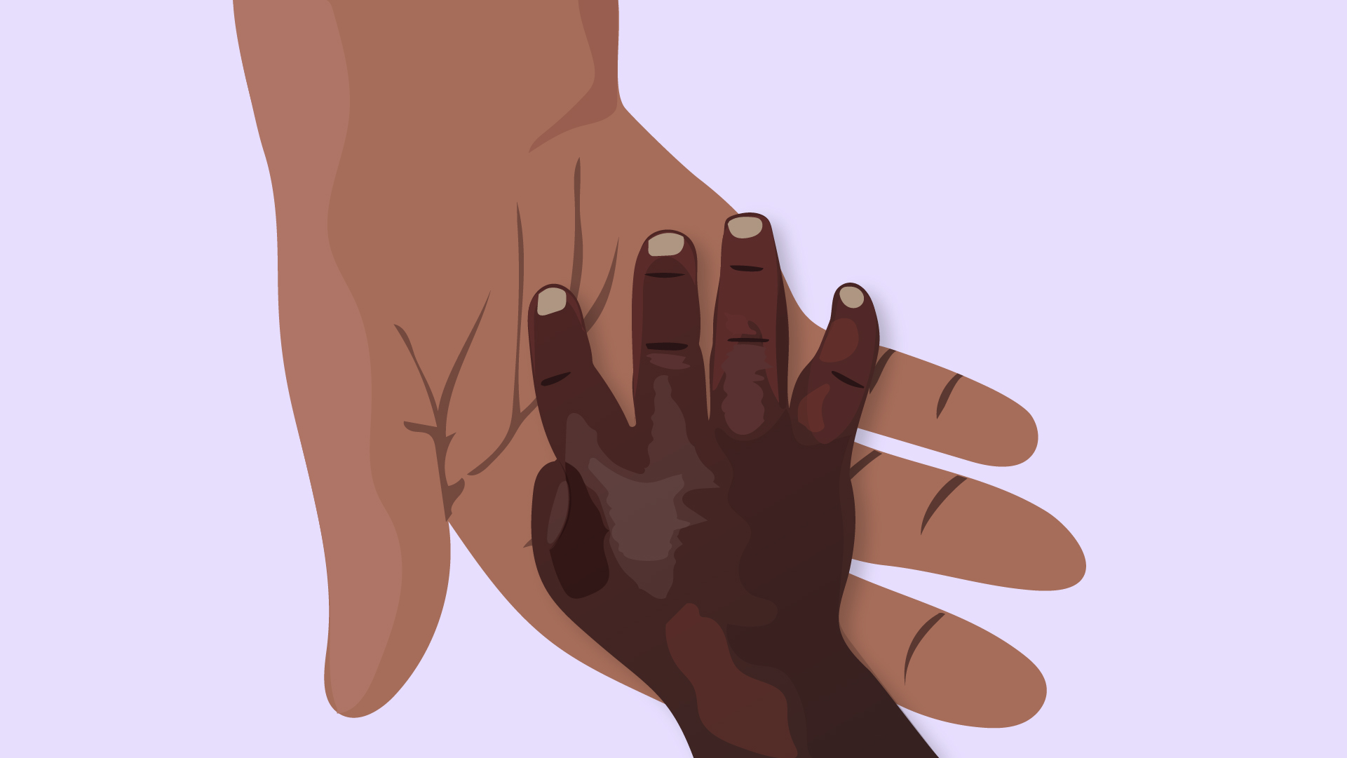 Ilustração de uma mão de um adulto segurando uma mão de uma criança com doença falciforme, com o sintoma característico da condição: inchaço nas mãos.