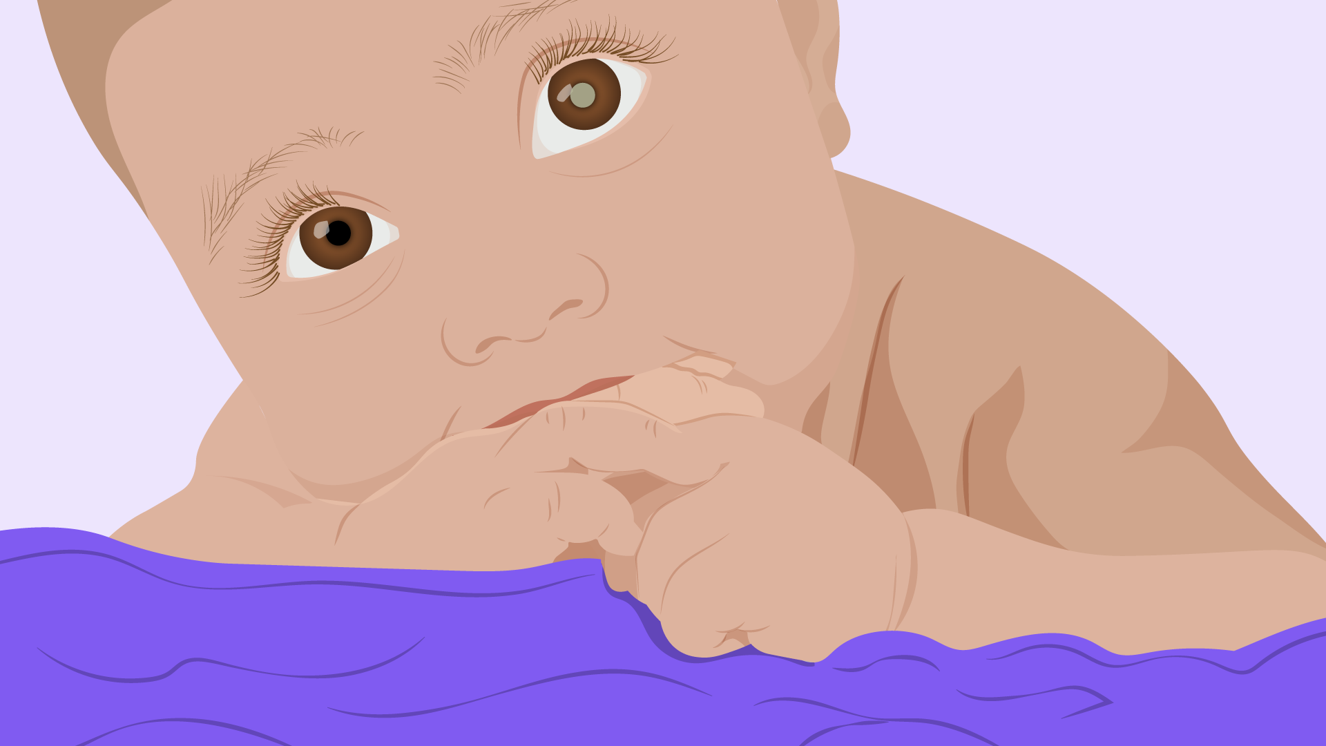 Bebê com reflexo branco no olho, sugestivo de um retinoblastoma.