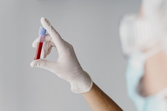 Hemofilia: o que é, genética, triagem neonatal