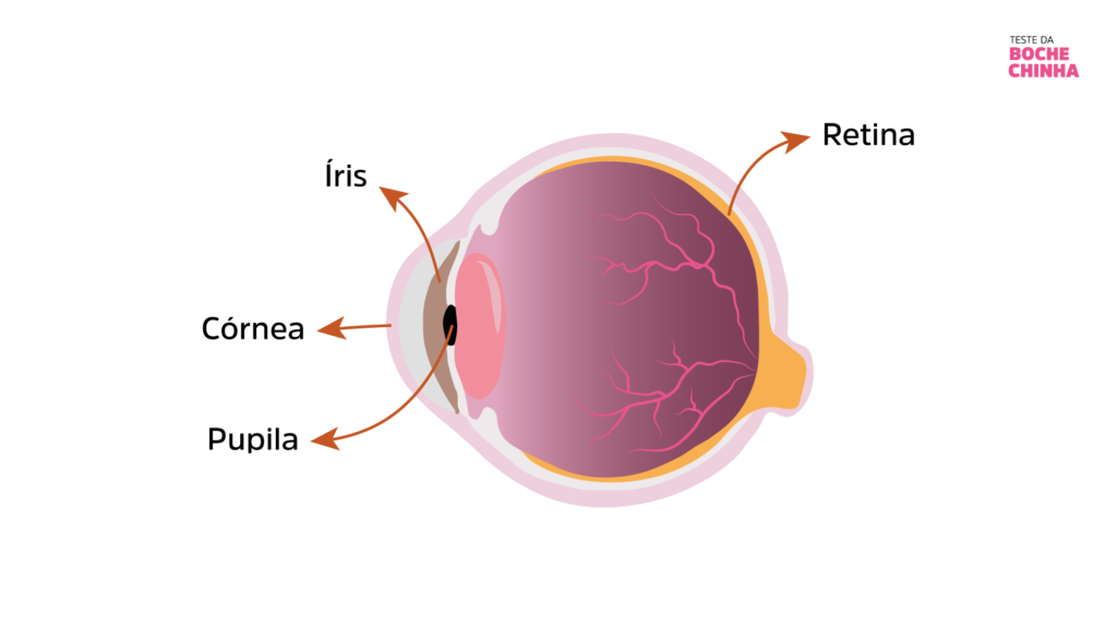 Retina - retinoblastoma