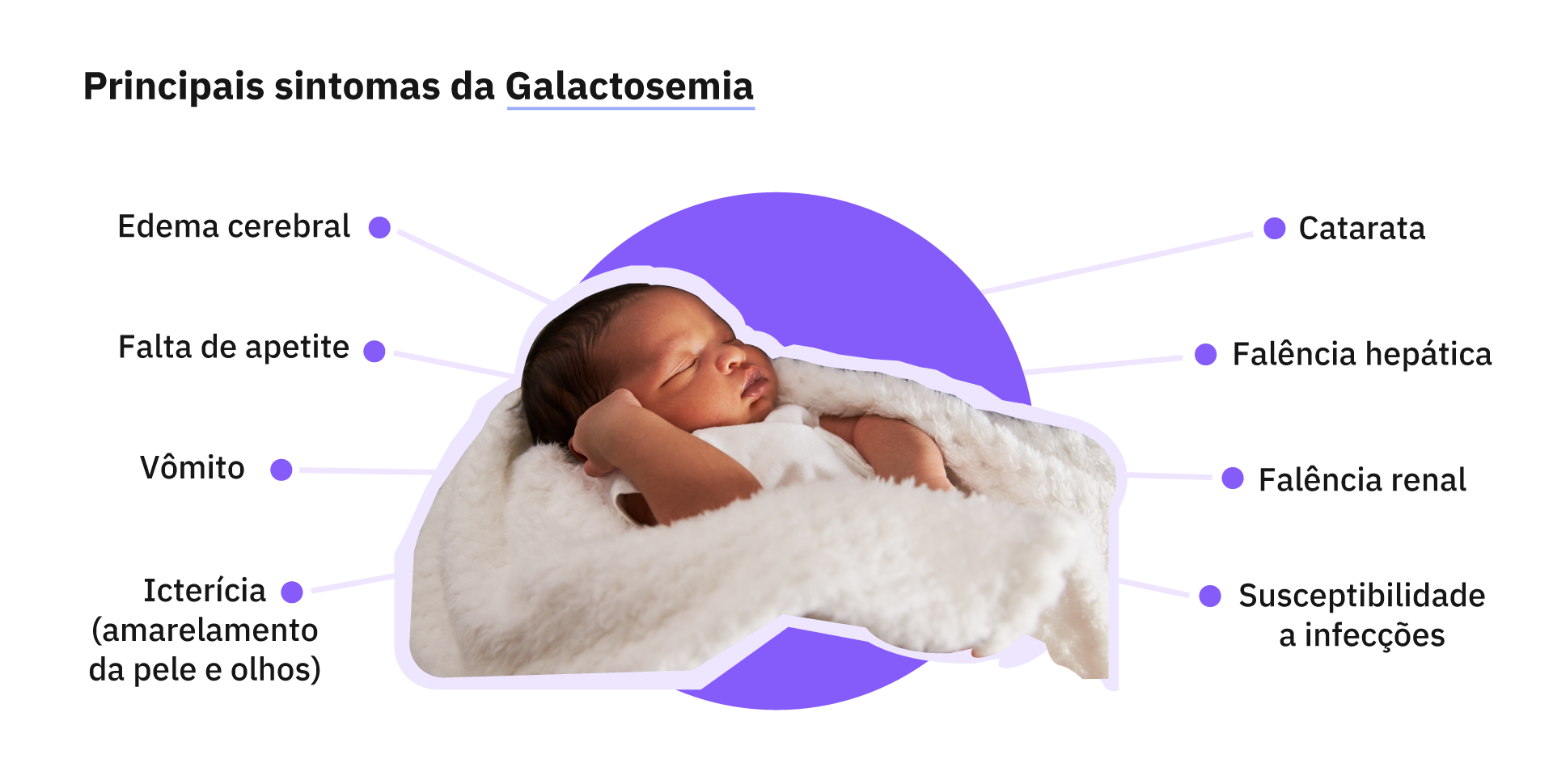 Sintomas da galactosemia