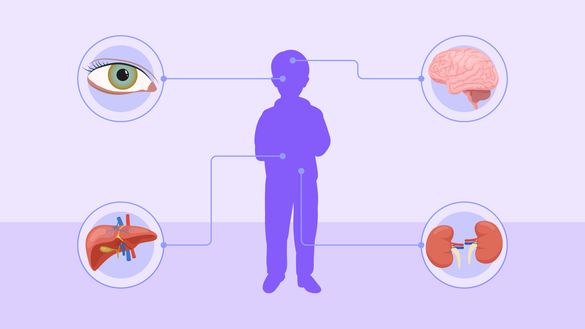 Uma criança em destaque roxo, com elementos ao redor em círculos: olho, fígado, cérebro e rins.