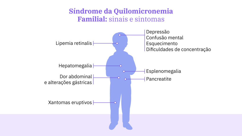 Ilustração da silhueta de uma criança com setas apontando para as partes do corpo onde ocorrem os principais sintomas da síndrome da quilomicronemia familial.