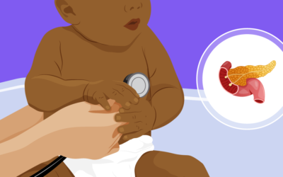 Síndrome da Quilomicronemia Familial: causas, sintomas e diagnóstico