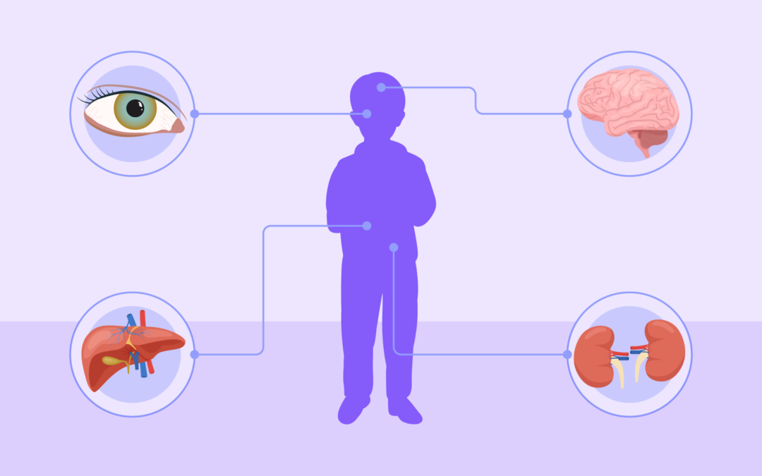 Doença de Wilson: entenda a condição