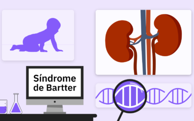 Síndrome de Bartter